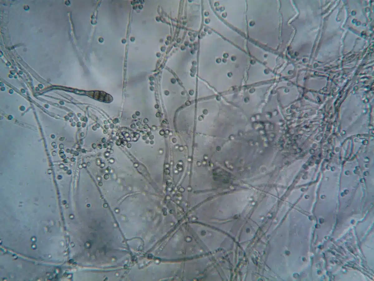 Microfotografía de esporas de hongo penetrando la cutícula de un insecto