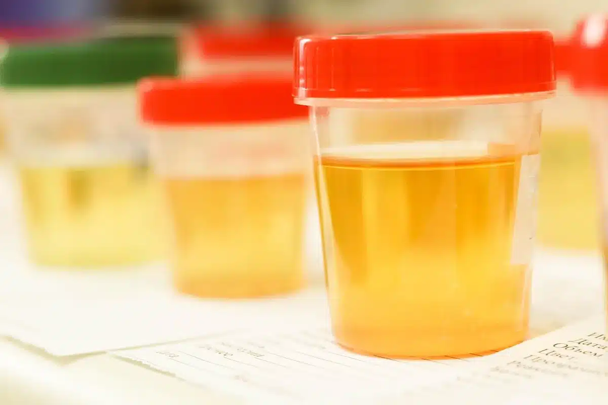 Investigador en laboratorio observando ensayos clínicos